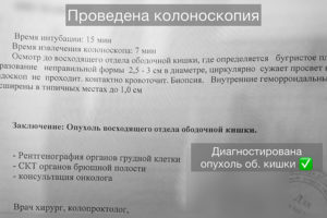 Опухоль восходящего отдела ободочной кишки