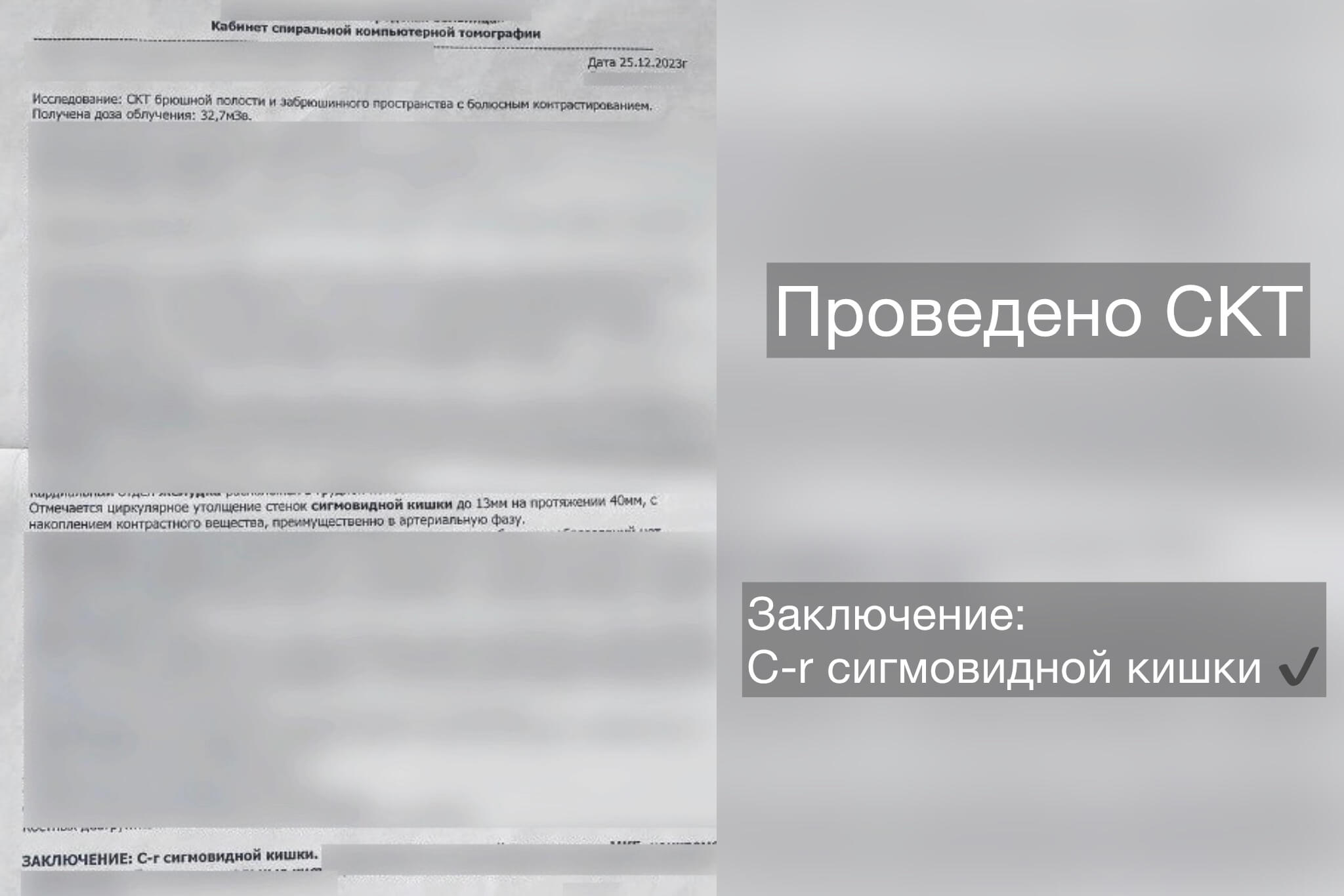 Заключение СКТ